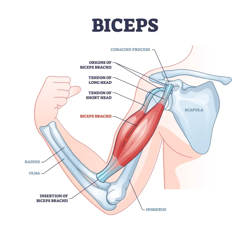 long head of biceps tendinopathy treatment Melbourne