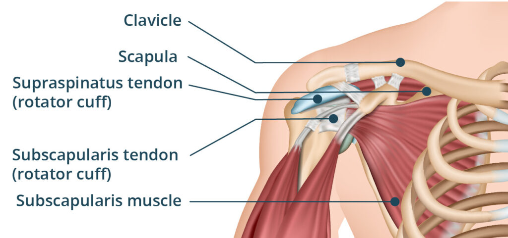 rotator-cuff related shoulder pain